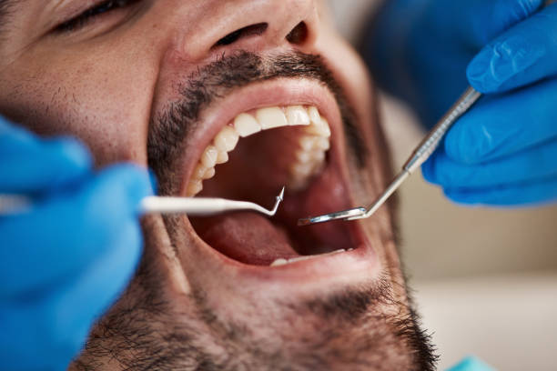 Best Emergency Dentist for Knocked-Out Tooth in Herriman, UT